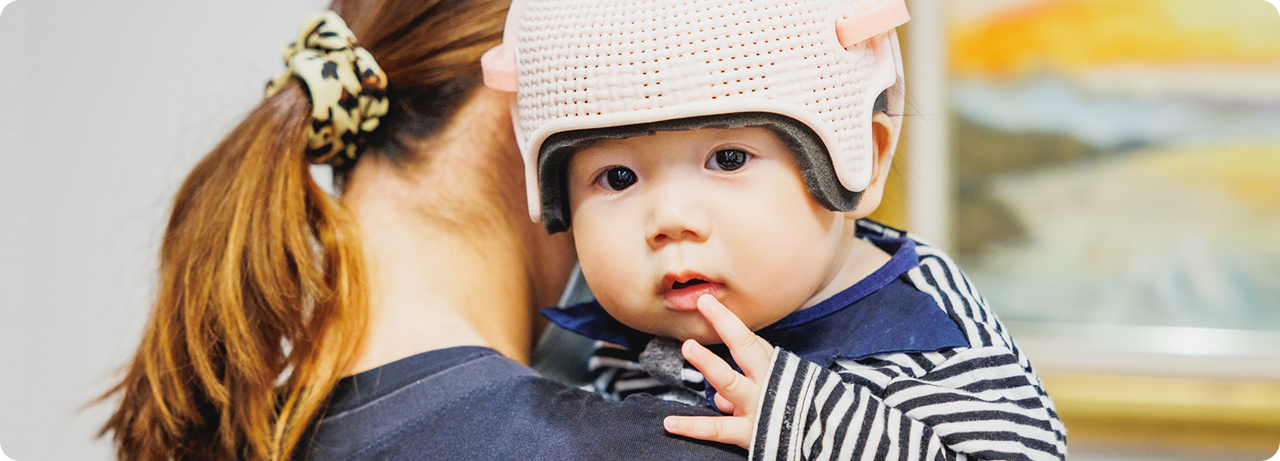 赤ちゃんの頭の形のための 頭蓋骨矯正ヘルメット治療